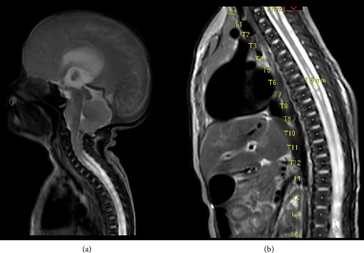 https://cdn.ncbi.nlm.nih.gov/pmc/blobs/cb46/12317807/53b93efdfaa6/CRIPE2025-5569749.001.jpg