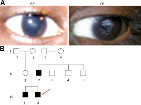 https://cdn.ncbi.nlm.nih.gov/pmc/blobs/cb4b/2956670/a95b8a48da6d/mv-v16-1837-f8.jpg