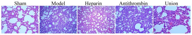 https://cdn.ncbi.nlm.nih.gov/pmc/blobs/cb4d/5865868/6221d06907c8/mmr-16-05-7375-g00.jpg
