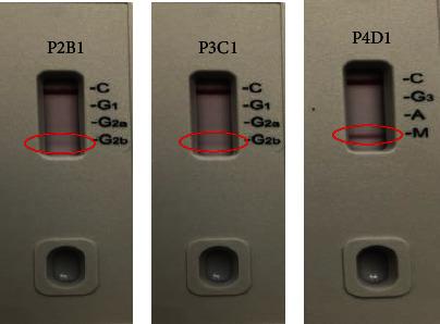 https://cdn.ncbi.nlm.nih.gov/pmc/blobs/cb54/11093687/41399e7949dd/VMI2024-6901355.013.jpg