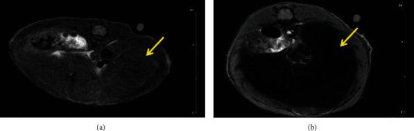https://cdn.ncbi.nlm.nih.gov/pmc/blobs/cb58/7953590/90b53189c5d6/MOI2021-6677847.005.jpg