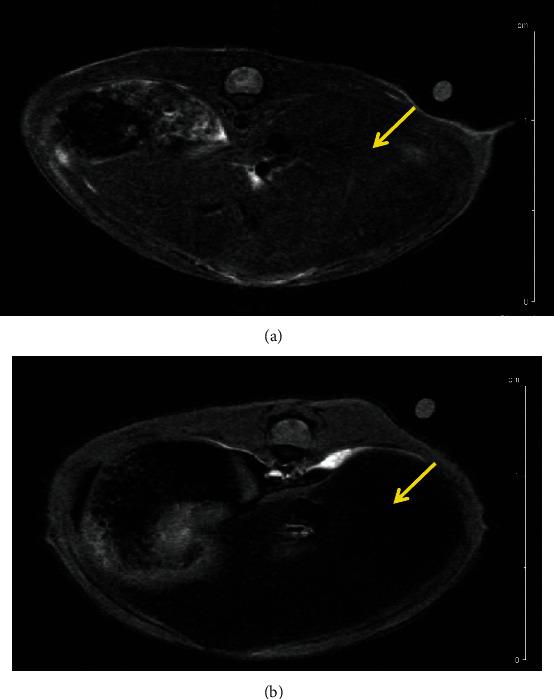 https://cdn.ncbi.nlm.nih.gov/pmc/blobs/cb58/7953590/c8fa1b75b6be/MOI2021-6677847.003.jpg