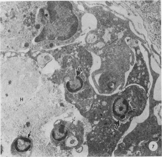 https://cdn.ncbi.nlm.nih.gov/pmc/blobs/cb59/2040808/d2afd8402518/brjexppathol00101-0047-a.jpg