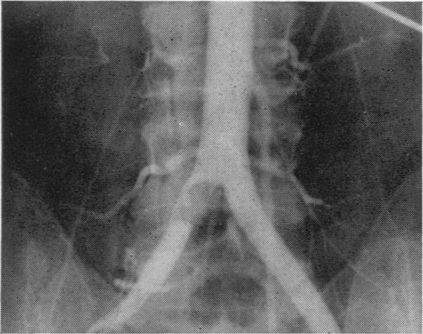 https://cdn.ncbi.nlm.nih.gov/pmc/blobs/cb64/2377934/59d70ce313da/annrcse00306-0044-a.jpg