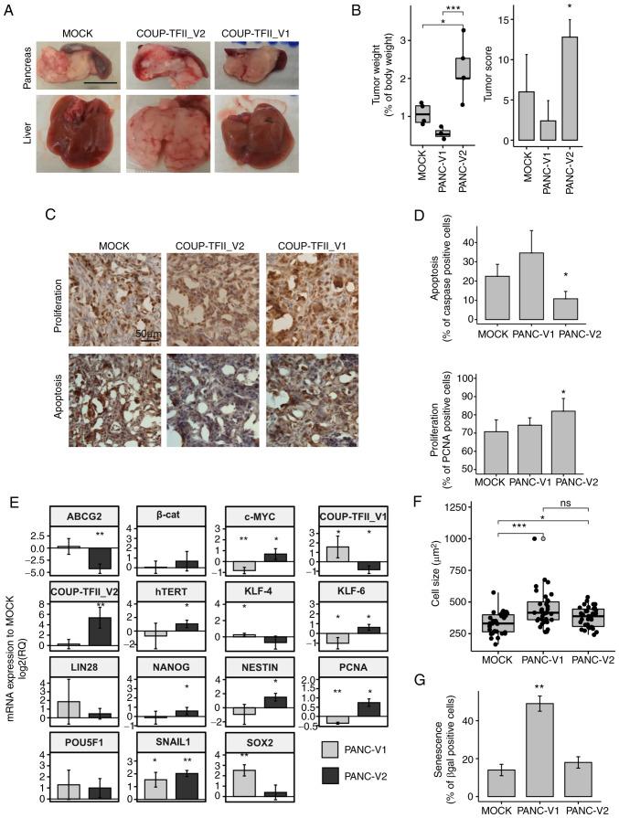 https://cdn.ncbi.nlm.nih.gov/pmc/blobs/cb65/8997336/fda9561b1f9c/IJO-60-05-05345-g04.jpg