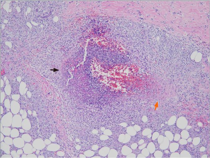 https://cdn.ncbi.nlm.nih.gov/pmc/blobs/cb6b/7789062/e6f7ca602c06/WJG-27-19-g002.jpg
