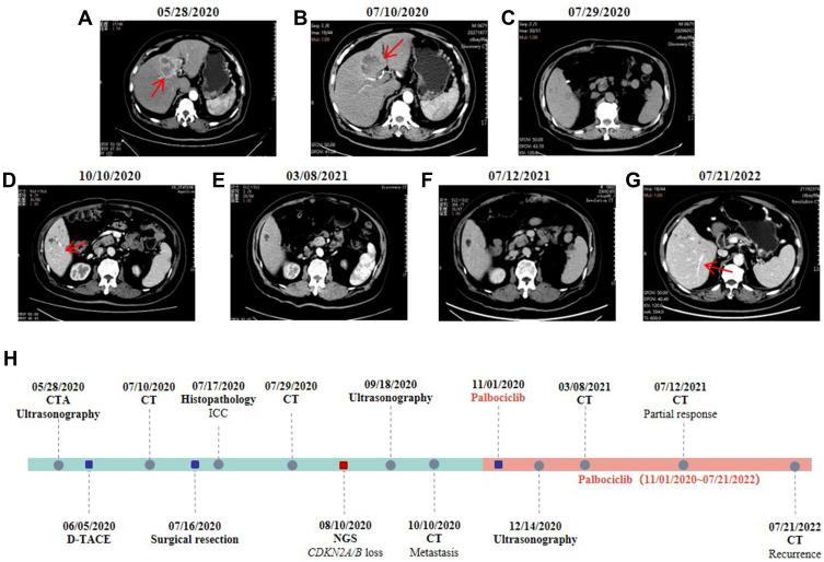 https://cdn.ncbi.nlm.nih.gov/pmc/blobs/cb6c/9869796/49d6e386108c/OTT-16-23-g0001.jpg