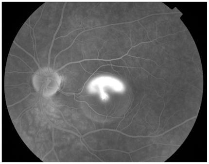 https://cdn.ncbi.nlm.nih.gov/pmc/blobs/cb72/3161640/5b8f8a6ce9b9/cmo-2-2008-037f2c.jpg