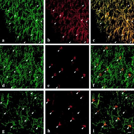 https://cdn.ncbi.nlm.nih.gov/pmc/blobs/cb75/2141744/81f51b6ae0d1/JCB12526.f5.jpg