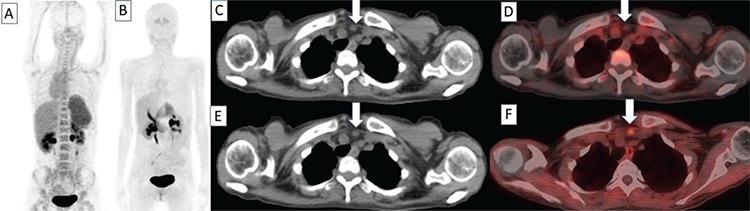 https://cdn.ncbi.nlm.nih.gov/pmc/blobs/cb75/9950688/c972fea49944/MIRT-32-1-g1.jpg