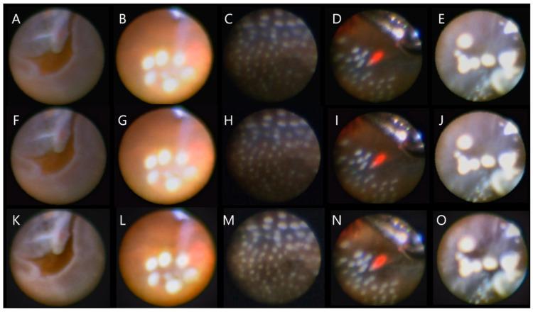 https://cdn.ncbi.nlm.nih.gov/pmc/blobs/cb76/9570689/b63f326e6981/jcm-11-05666-g001.jpg