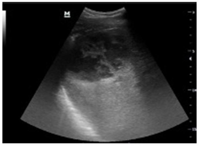 https://cdn.ncbi.nlm.nih.gov/pmc/blobs/cb77/8938823/0b52bd3d5068/tomography-08-00066-g006.jpg