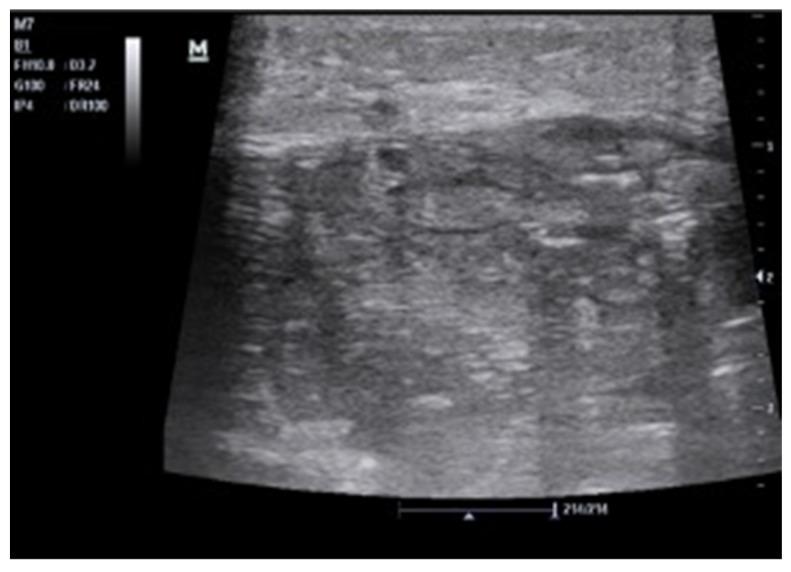 https://cdn.ncbi.nlm.nih.gov/pmc/blobs/cb77/8938823/a33ccbbb39e4/tomography-08-00066-g008.jpg