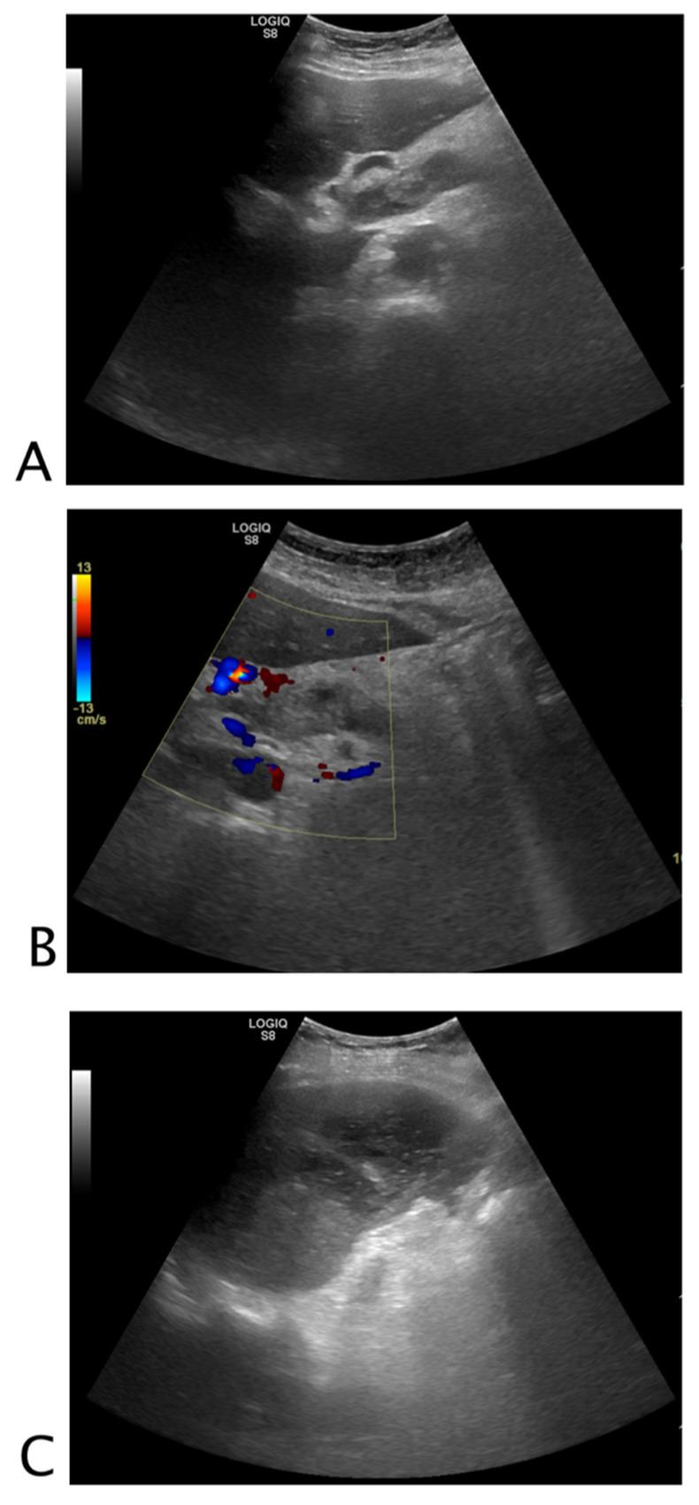https://cdn.ncbi.nlm.nih.gov/pmc/blobs/cb77/8938823/e52abf38f475/tomography-08-00066-g009.jpg