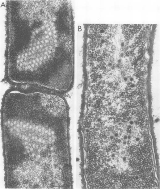 https://cdn.ncbi.nlm.nih.gov/pmc/blobs/cb7b/354888/5dd821ab82f0/jvirol00224-0232-a.jpg