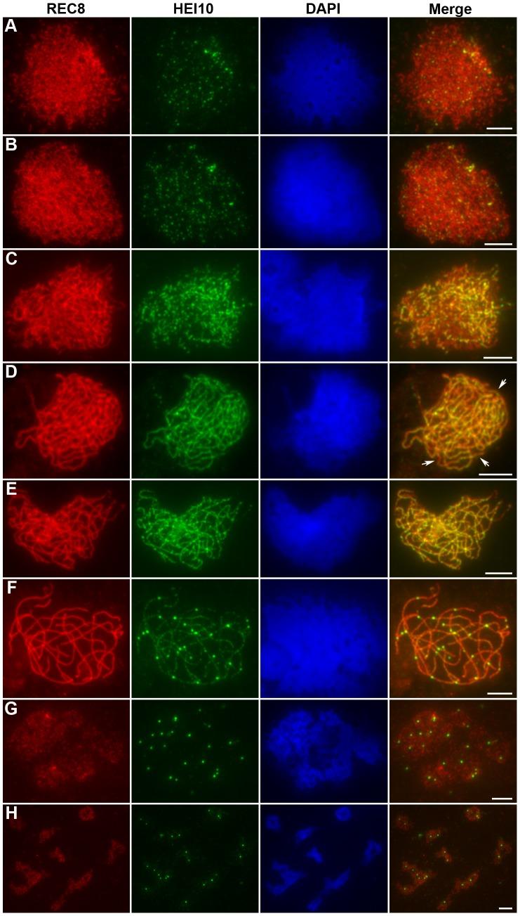 https://cdn.ncbi.nlm.nih.gov/pmc/blobs/cb81/3390396/e1306e05bea8/pgen.1002809.g005.jpg