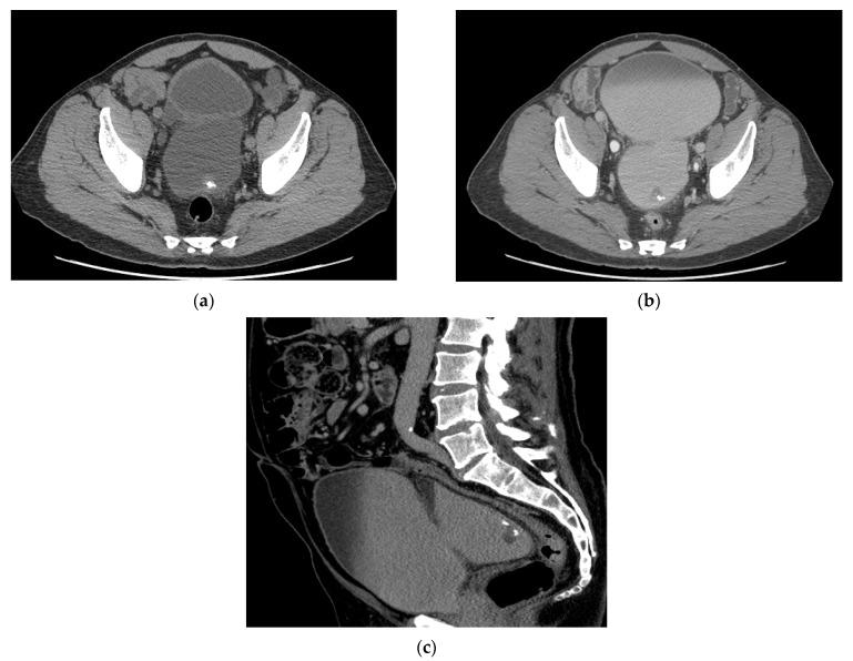 https://cdn.ncbi.nlm.nih.gov/pmc/blobs/cb88/8003397/16f909cd5488/cancers-13-01396-g004.jpg