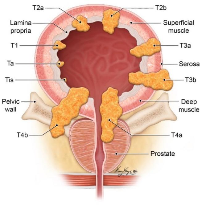 https://cdn.ncbi.nlm.nih.gov/pmc/blobs/cb88/8003397/22de78669756/cancers-13-01396-g001.jpg