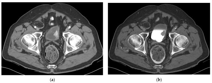 https://cdn.ncbi.nlm.nih.gov/pmc/blobs/cb88/8003397/2838086e1bf4/cancers-13-01396-g003.jpg