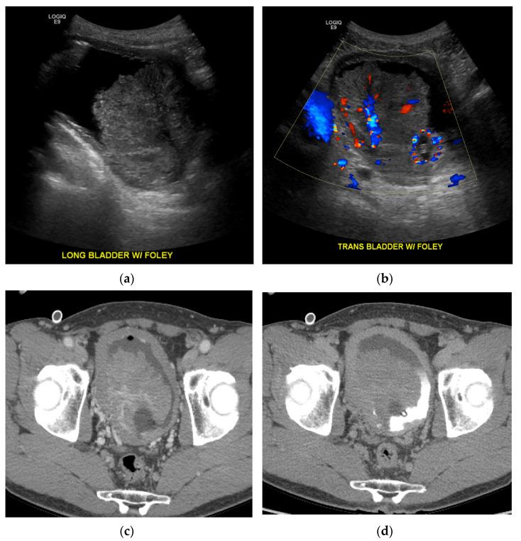https://cdn.ncbi.nlm.nih.gov/pmc/blobs/cb88/8003397/3558b0aae849/cancers-13-01396-g008.jpg
