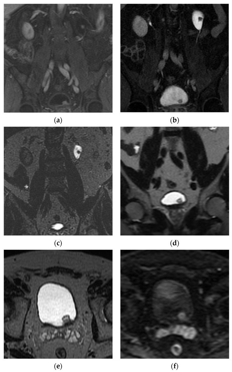 https://cdn.ncbi.nlm.nih.gov/pmc/blobs/cb88/8003397/3c6976ccfcf3/cancers-13-01396-g006.jpg