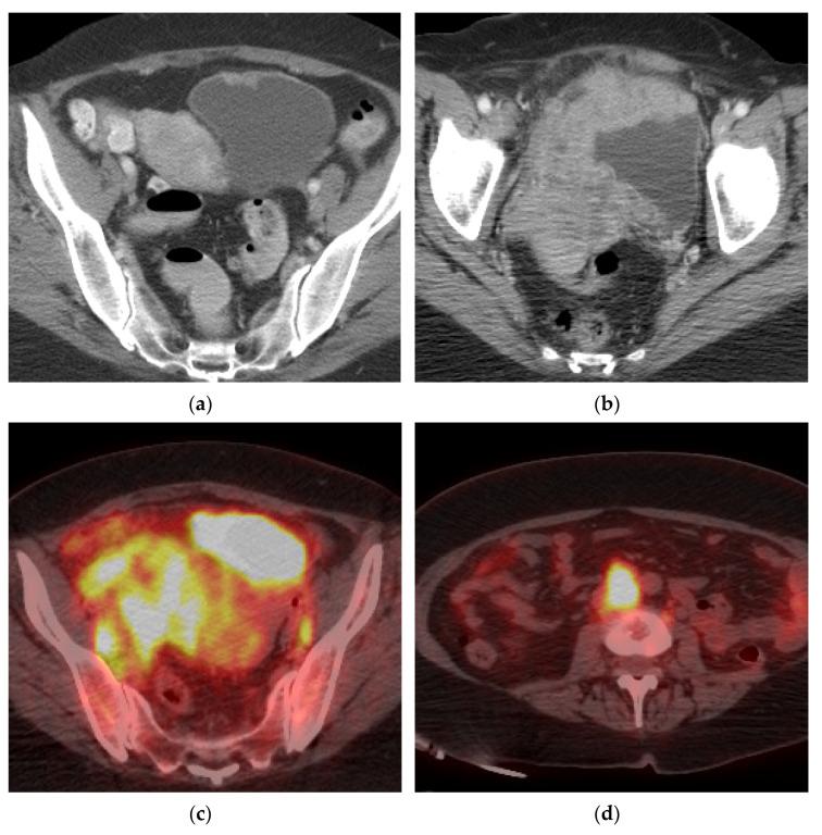 https://cdn.ncbi.nlm.nih.gov/pmc/blobs/cb88/8003397/7fc5b6690c5f/cancers-13-01396-g007a.jpg