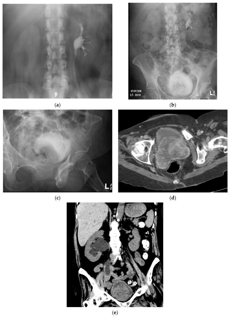 https://cdn.ncbi.nlm.nih.gov/pmc/blobs/cb88/8003397/b874c801ad1f/cancers-13-01396-g009.jpg