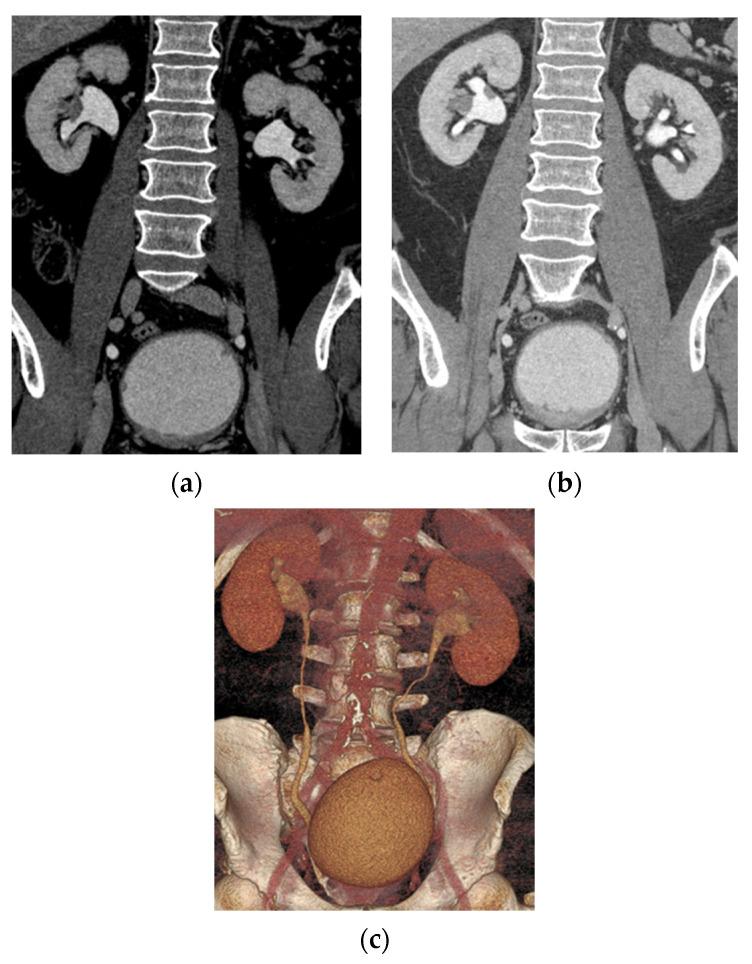 https://cdn.ncbi.nlm.nih.gov/pmc/blobs/cb88/8003397/fff9049939c6/cancers-13-01396-g002.jpg