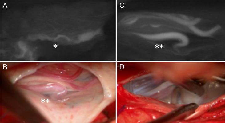 https://cdn.ncbi.nlm.nih.gov/pmc/blobs/cb90/12278957/131c65068f10/CASE25353_figure_2.jpg