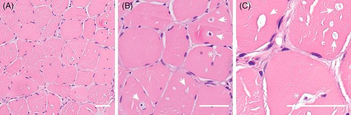 https://cdn.ncbi.nlm.nih.gov/pmc/blobs/cb90/9626661/c79b310e3dc0/JMD2-63-540-g002.jpg