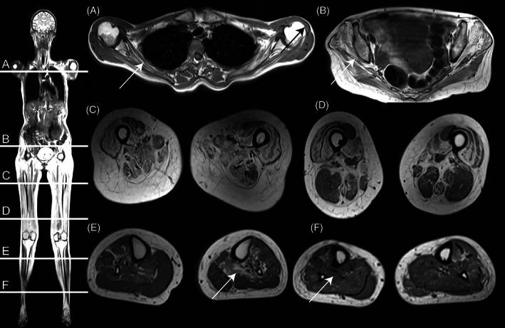 https://cdn.ncbi.nlm.nih.gov/pmc/blobs/cb90/9626661/f8d697f4b926/JMD2-63-540-g001.jpg
