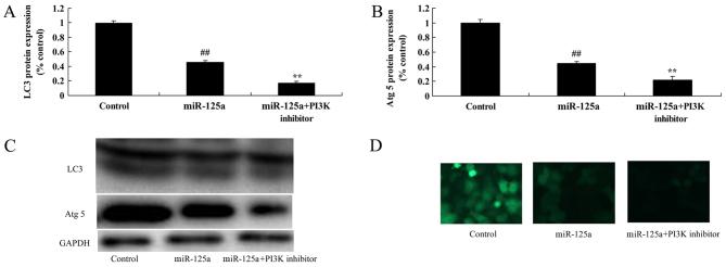 https://cdn.ncbi.nlm.nih.gov/pmc/blobs/cb93/6425124/0b9543107050/etm-17-04-2465-g08.jpg
