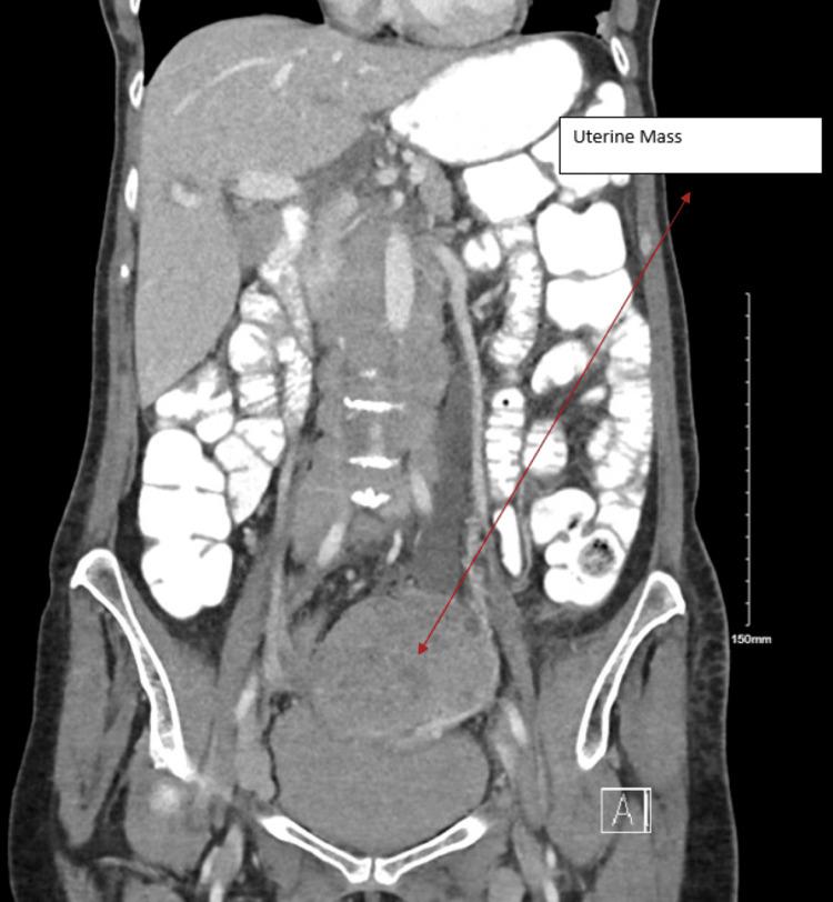 https://cdn.ncbi.nlm.nih.gov/pmc/blobs/cb94/10980271/9137d6506a09/cureus-0016-00000055153-i02.jpg