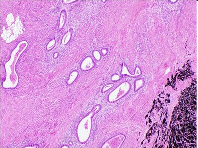 https://cdn.ncbi.nlm.nih.gov/pmc/blobs/cba0/11166675/3276cf4fea48/DEO2-5-e395-g004.jpg