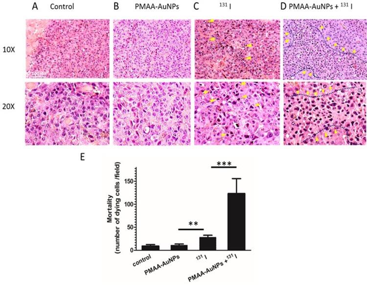 https://cdn.ncbi.nlm.nih.gov/pmc/blobs/cba0/6777639/75076d067a71/IJN-14-7933-g0007.jpg