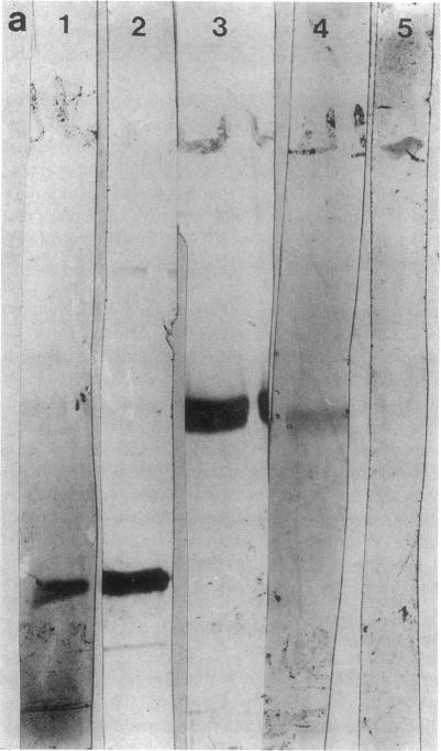 https://cdn.ncbi.nlm.nih.gov/pmc/blobs/cba4/294246/ab3815c480c3/jcinvest00033-0452-a.jpg
