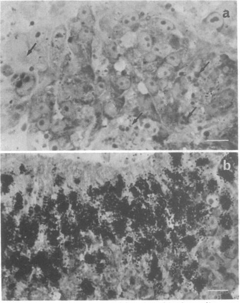 https://cdn.ncbi.nlm.nih.gov/pmc/blobs/cba4/383863/b6704f8eacf3/pnas00007-0504-b.jpg