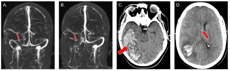 https://cdn.ncbi.nlm.nih.gov/pmc/blobs/cba7/9477649/104655300594/cureus-0014-00000028083-i01.jpg