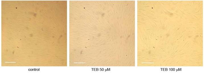 https://cdn.ncbi.nlm.nih.gov/pmc/blobs/cbb1/6268439/da3850997f30/molecules-17-07864-g005.jpg