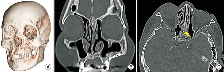 https://cdn.ncbi.nlm.nih.gov/pmc/blobs/cbb4/11535127/c75760dfe97e/jkaoms-50-5-273-f8.jpg