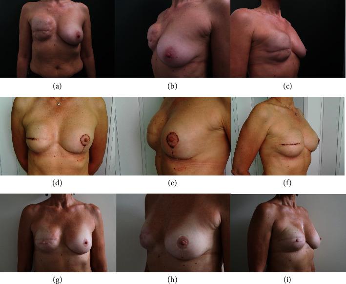 https://cdn.ncbi.nlm.nih.gov/pmc/blobs/cbb8/10914432/49d4d09c0833/TBJ2024-9097040.002.jpg