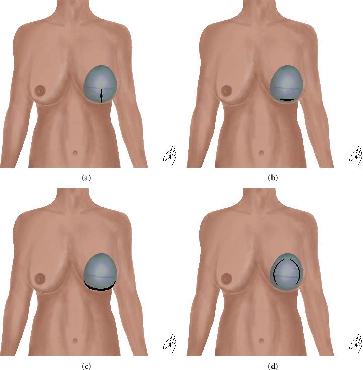 https://cdn.ncbi.nlm.nih.gov/pmc/blobs/cbb8/10914432/5e5a2fd4ed30/TBJ2024-9097040.001.jpg