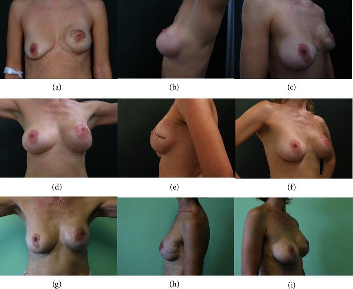 https://cdn.ncbi.nlm.nih.gov/pmc/blobs/cbb8/10914432/de510b875c2d/TBJ2024-9097040.003.jpg