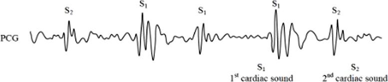 https://cdn.ncbi.nlm.nih.gov/pmc/blobs/cbb8/12176565/4e8758f7eeb6/fphys-16-1596150-g001.jpg