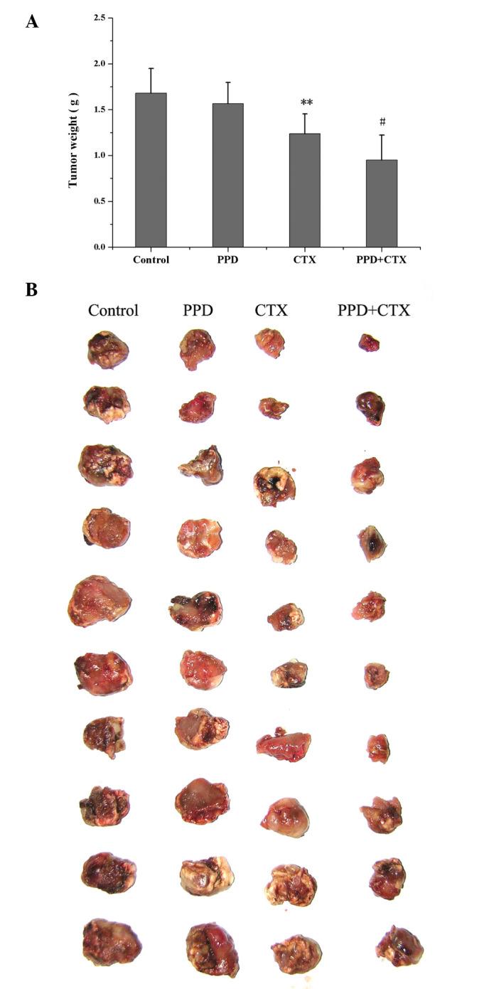 https://cdn.ncbi.nlm.nih.gov/pmc/blobs/cbc4/3570184/5ac4e1152371/ETM-05-02-0443-g01.jpg