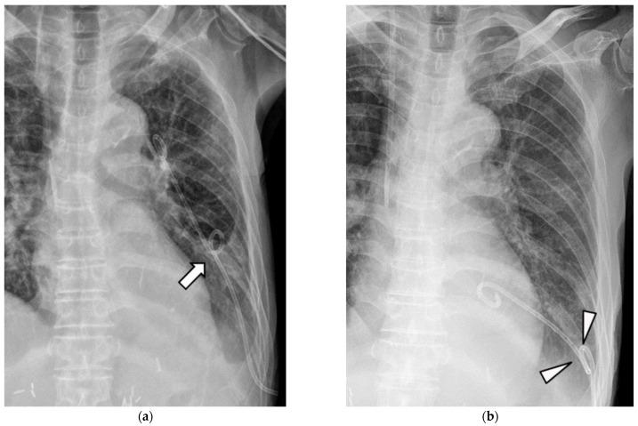 https://cdn.ncbi.nlm.nih.gov/pmc/blobs/cbc8/10303575/cab54baf7ecf/medicina-59-01089-g004.jpg