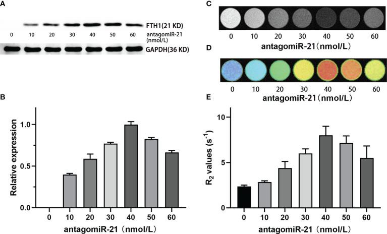 https://cdn.ncbi.nlm.nih.gov/pmc/blobs/cbc9/8602822/20a9372f7a4c/fonc-11-747305-g004.jpg