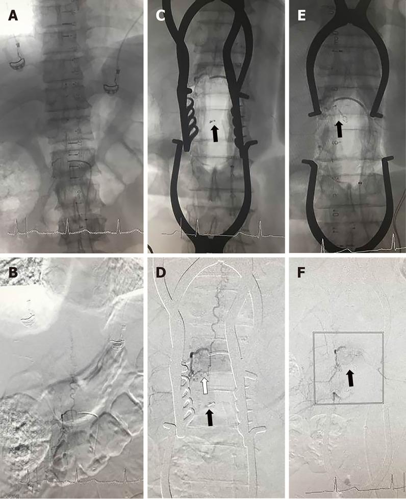 https://cdn.ncbi.nlm.nih.gov/pmc/blobs/cbcb/7103968/4e2612bbef96/WJCC-8-1056-g002.jpg