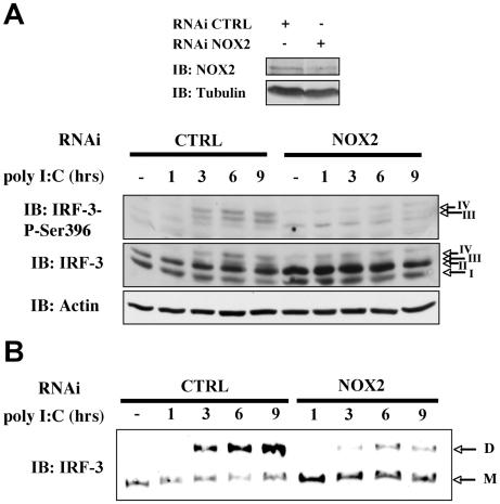 https://cdn.ncbi.nlm.nih.gov/pmc/blobs/cbcc/2880583/3c99214b9ecc/ppat.1000930.g007.jpg