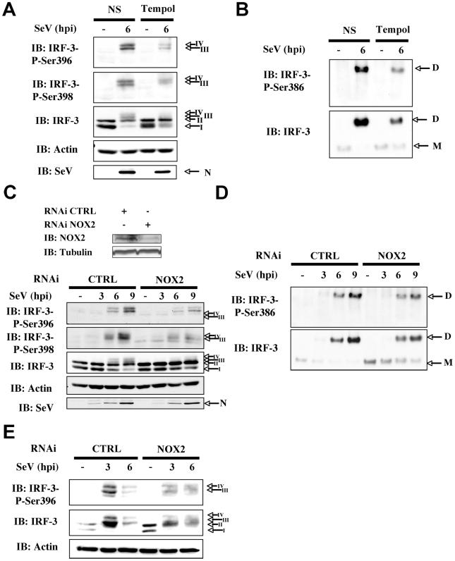 https://cdn.ncbi.nlm.nih.gov/pmc/blobs/cbcc/2880583/d1f5c38382be/ppat.1000930.g003.jpg